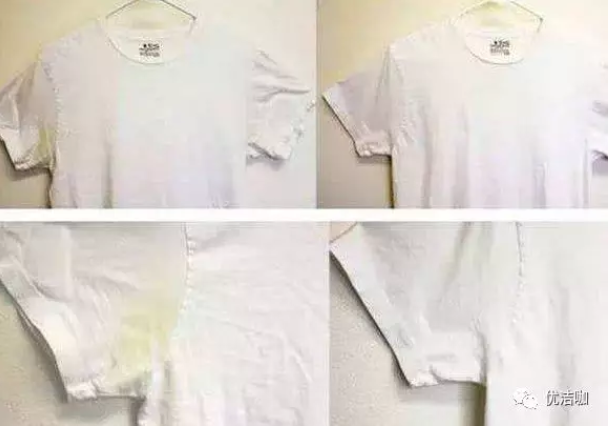 大连红山区身体出现这些症状,小心发生了腋臭