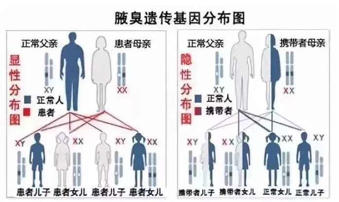 大连阿鲁科尔沁旗腋臭复发怎么办