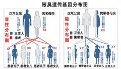 大连阿鲁科尔沁旗腋臭,我该拿你怎么办?